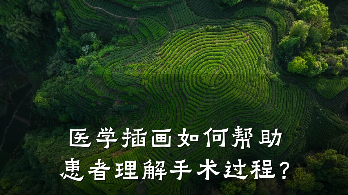医学插画如何帮助患者理解手术过程?