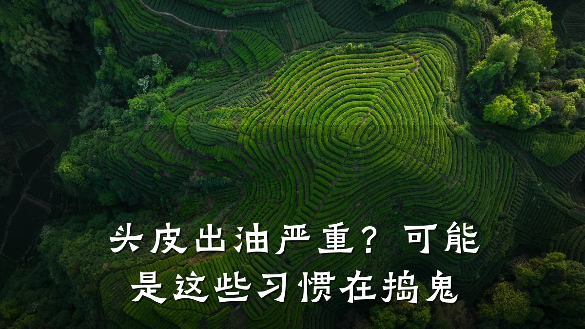 头皮出油严重?可能是这些习惯在捣鬼